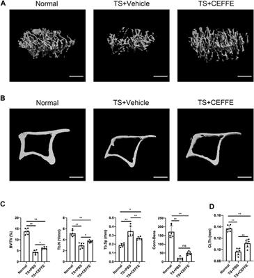 Cell-Free Fat Extract Prevents Tail Suspension–Induced Bone Loss by Inhibiting Osteocyte Apoptosis